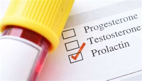 prolactin blood test nhs